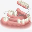 Próteses Dentárias